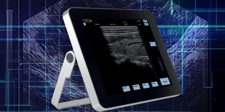 Echographie – Echoscopie