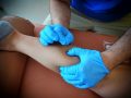 Formation en Dry-Needling